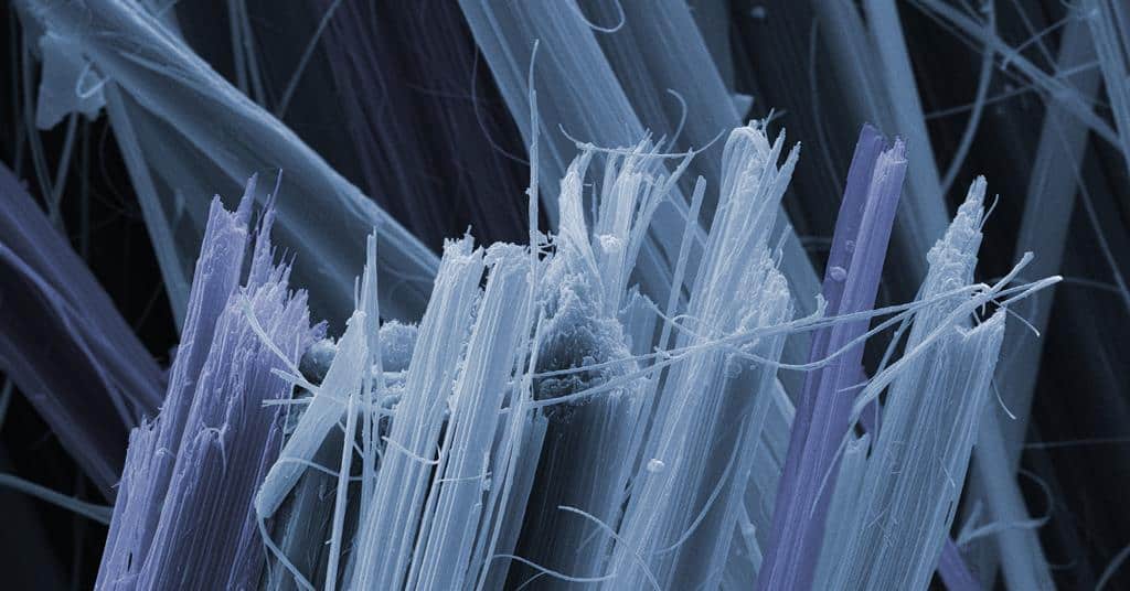 Microscopic view of asbestos fibers, illustrating their deadly potential when inhaled.